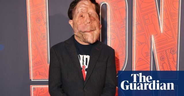 Adam Pearson de un hombre diferente para protagonizar una nueva película de The Elephant Man | Película
