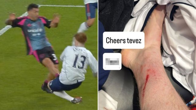 Angry Ginge llama al ex hombre Utd Star A 'Tw*t' mientras muestra una herida en la pierna después de cruzar el tackle en Soccer Aid
