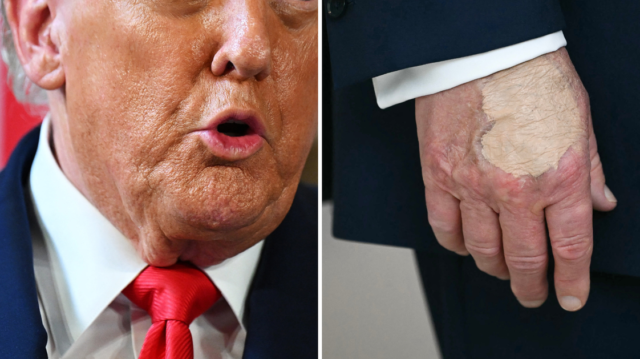 La situación de maquillaje y rociado de Donald Trump, explicada por profesionales
