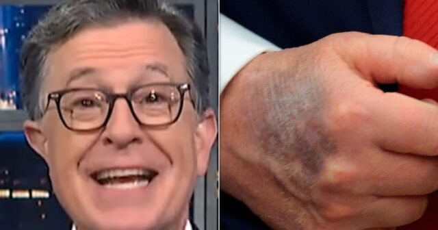 Stephen Colbert tiene una teoría sobre ese hematoma en la mano de Trump
